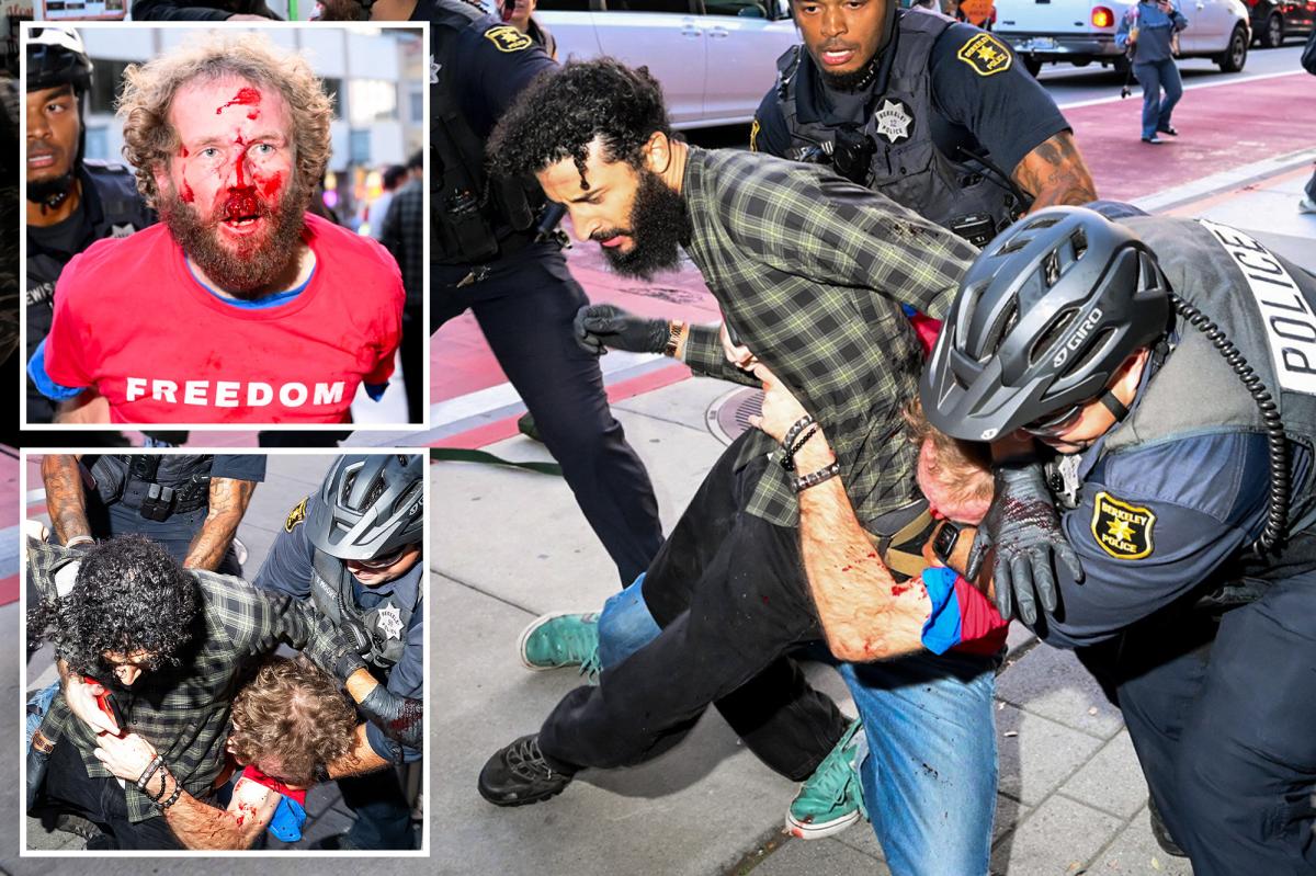 Protester 'Jihad' Charged with Assault and Robbery at Berkeley Rally
