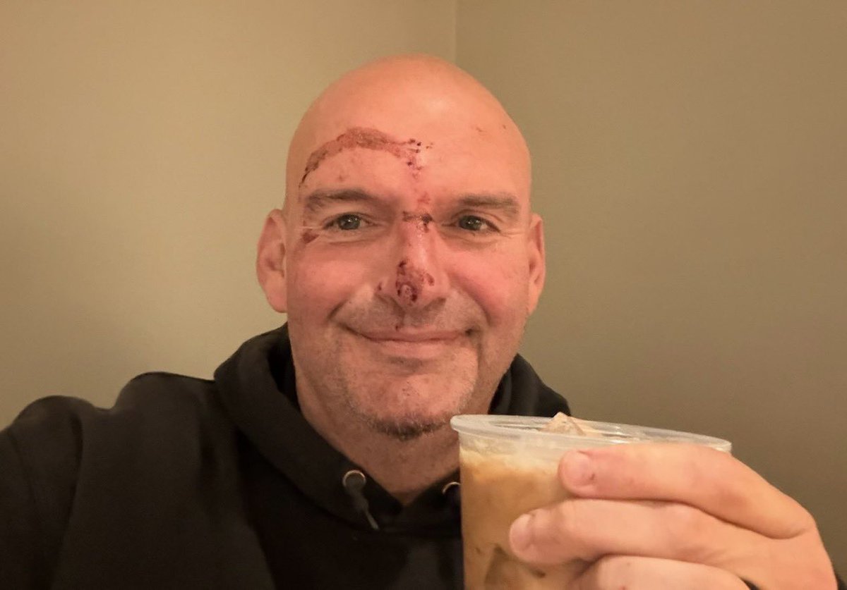 Senator John Fetterman Hospitalized After Fall, Shares Battle Scar Photo